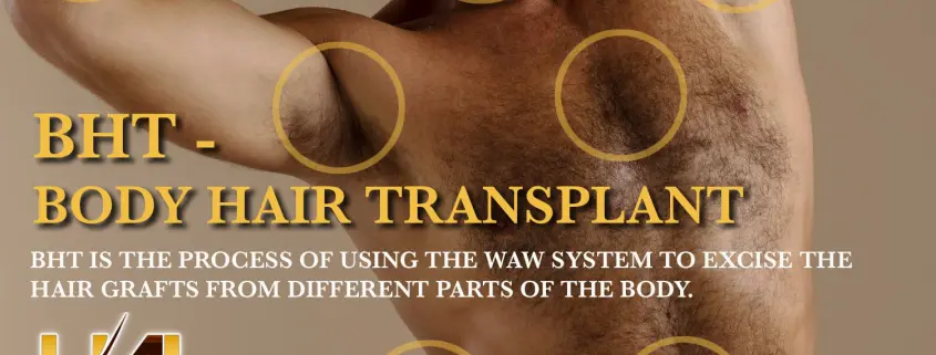 BHT - Body Hair Transplant - Hair 4 LIfe
