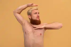 Comparing BHT to Traditional Hair Transplants - Hair 4 Life Medical Hair 4 Life Medical - Dr. Kelemen