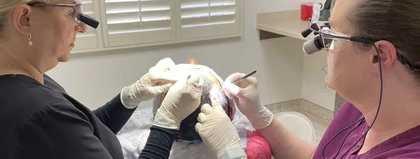 FUE hair transplant - Dr. Kelemen at Hair 4 Life 2 - Hair 4 Life Medical Hair 4 Life Medical - Dr. Kelemen