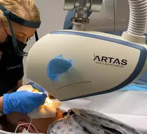ARTAS-Robotic-Hair-Restoration-Hair 4 LIfe