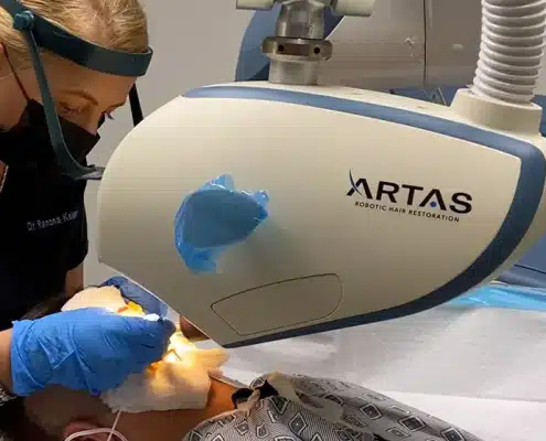ARTAS-Robotic-Hair-Restoration-Hair 4 LIfe