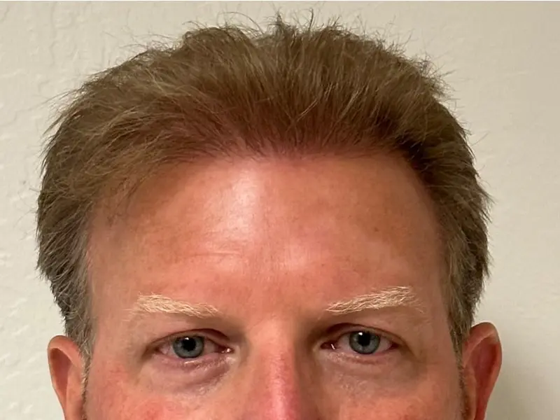 Hair 4 Life Medical - Dr. Kelemen