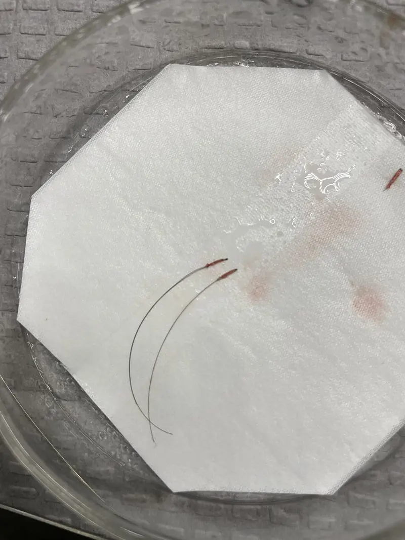 BHT - Body Hair Transplant 3 BHT - Body Hair Transplant 1