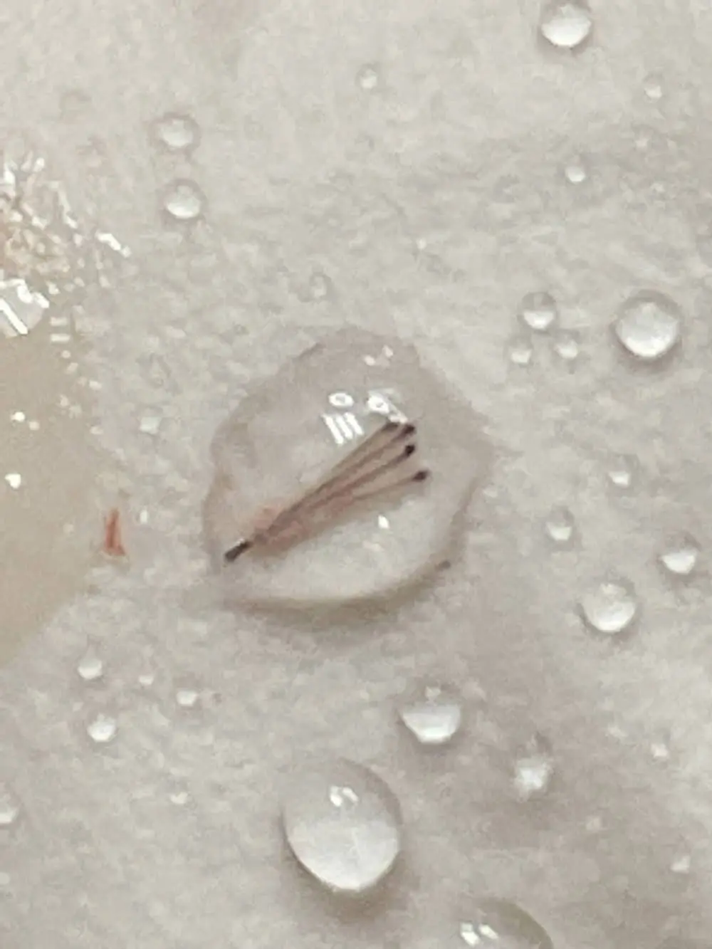 BHT - Body Hair Transplant 4 BHT - Body Hair Transplant 1