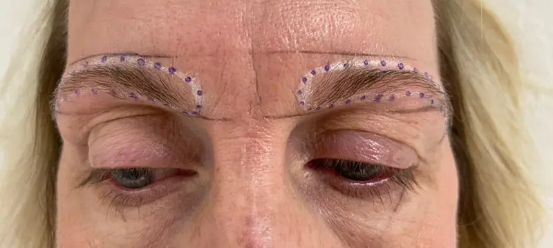 Hair 4 Life Medical - Dr. Kelemen