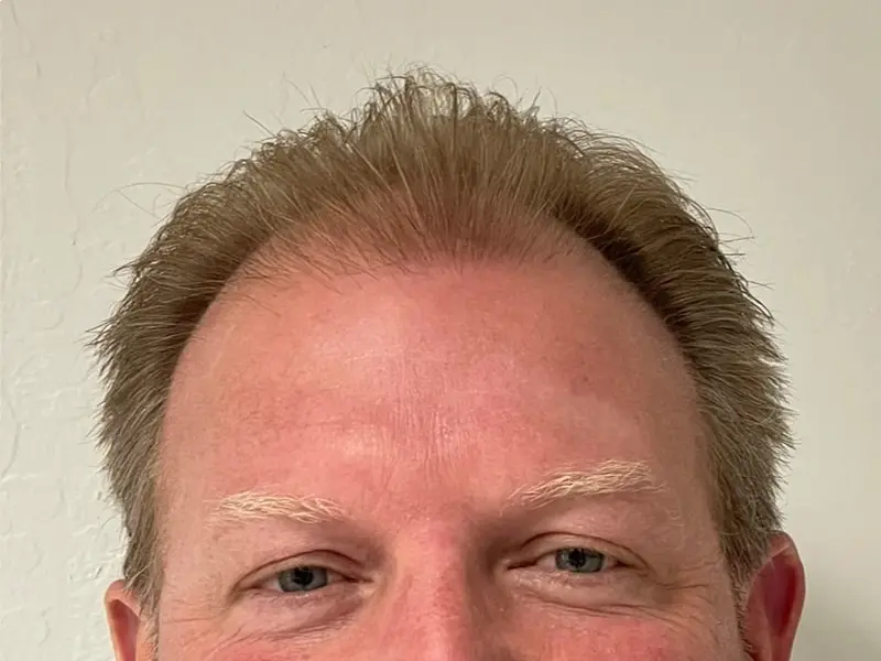 Hair 4 Life Medical - Dr. Kelemen