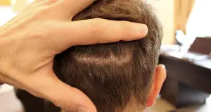 Hair 4 Life Medical - Dr. Kelemen