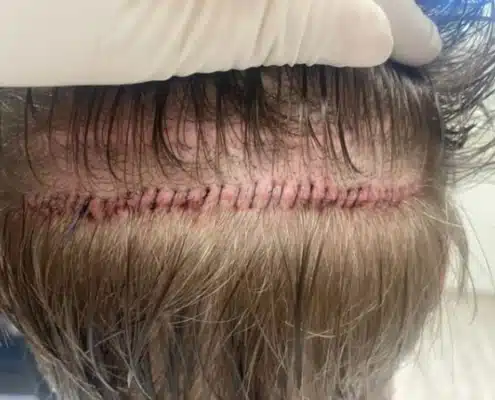 Hair 4 Life Medical - Dr. Kelemen