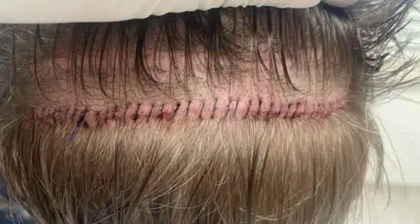 Hair 4 Life Medical - Dr. Kelemen