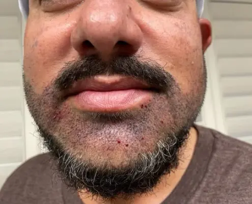 Hair 4 Life Medical - Dr. Kelemen