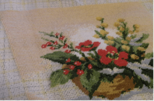 corrective hair transplant surgery 4 - Hair 4 Life Medical corrective hair transplant surgery