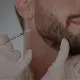 Injectables for beard hair maintenance