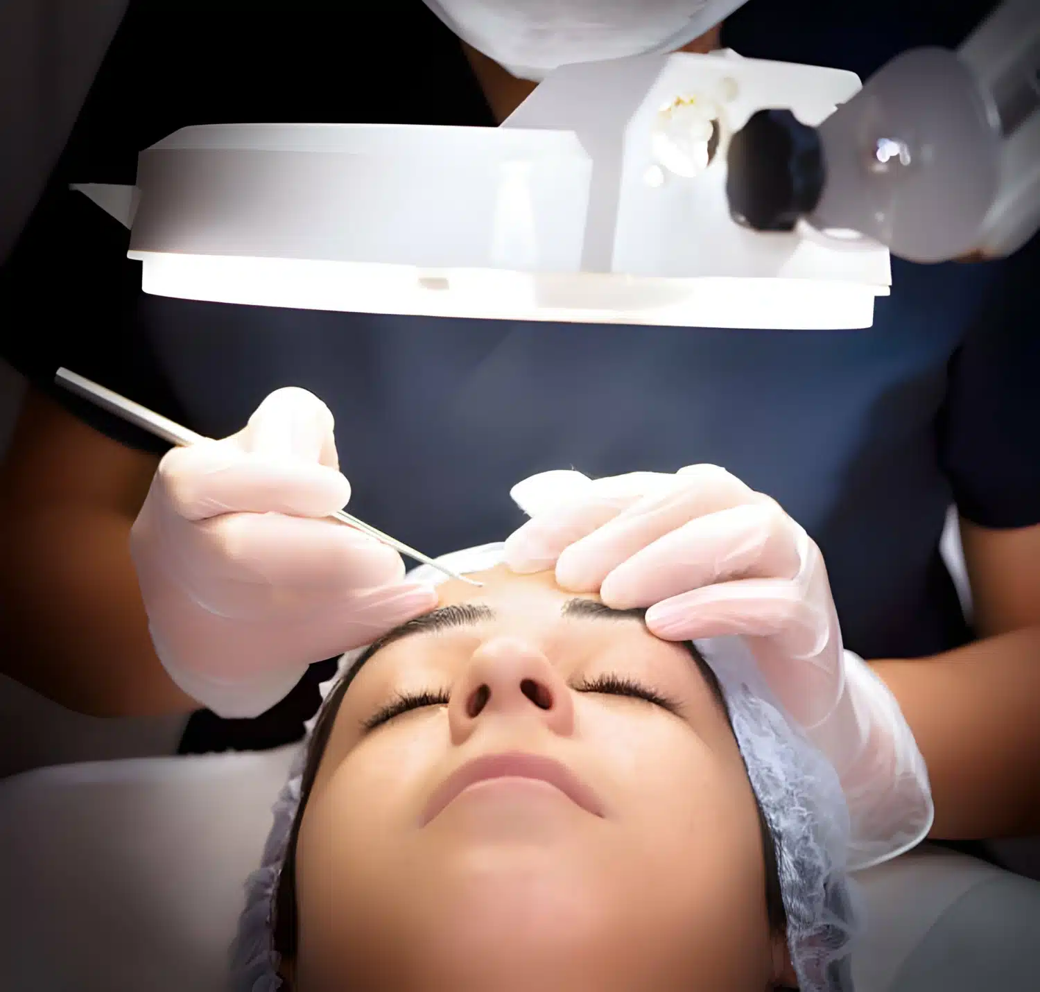 Eyebrow hair transplant Eyebrow hair trasnsplant