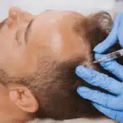 Injectable-for hair loss - Hair 4 Life Medical Solutions for Hair Loss