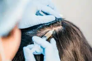 injectables for hair loss and hair health maintenance - Hair 4 Life Medical Benefits of Oral Medications