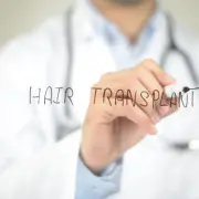 Hair,Transplant,,,Doctor,Writing,On,Transparent,Screen - Hair 4 Life Medical Robotic Hair Transplant