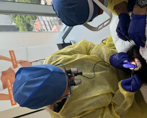 Long hair FUE workshop in Mexico City