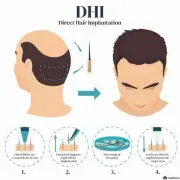 DHI - Hair 4 Life Medical DHI diagram