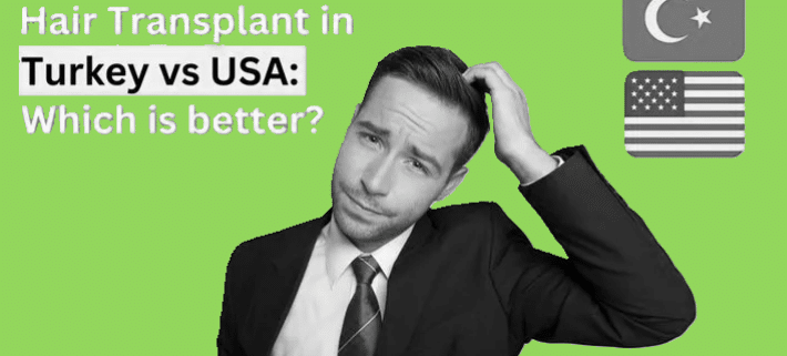 Turkey vs US hair transplant