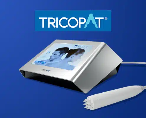 Tricopat-hair-loss-treatment Tricopat Hair Loss Treatment