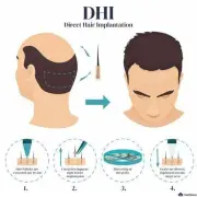 dhi - Hair 4 Life Medical DHI hair transplant explanation