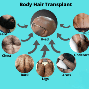 BHTimage - Hair 4 Life Medical