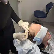 Dr Kelemen hairline - Hair 4 Life Medical Dr Kelemen during FUE procedure: site making.
