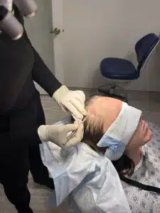 Dr Kelemen hairline Dr Kelemen during FUE procedure: site making.