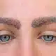 Eyebrow hair transplant FUE