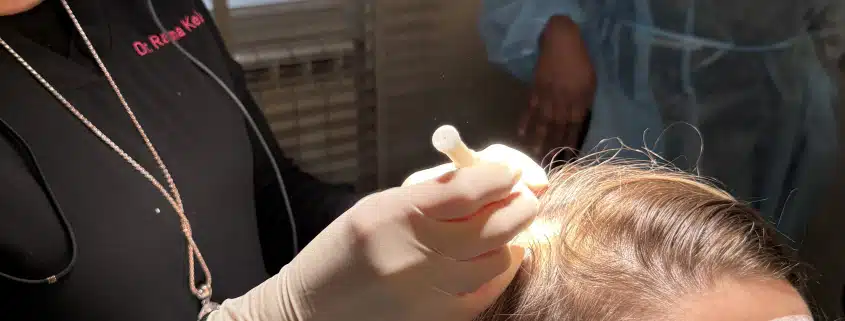 DHI - Hair 4 Life Medical DHI by Dr Kelemen