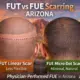FUEvsFUTscarhairtransplant - Hair 4 Life Medical FUT vs FUE scaring