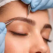 eyebrowhairtransplantH4LM - Hair 4 Life Medical FUE Eyebrow transplant