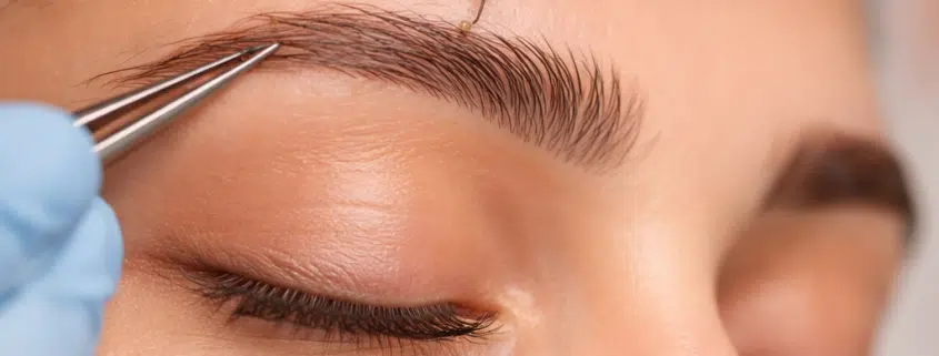 FUE Eyebrow transplant